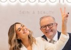 AI Memes Make Albanese Look Handsome — Startups Warn CGT Shake-up Could Send Innovation Overseas